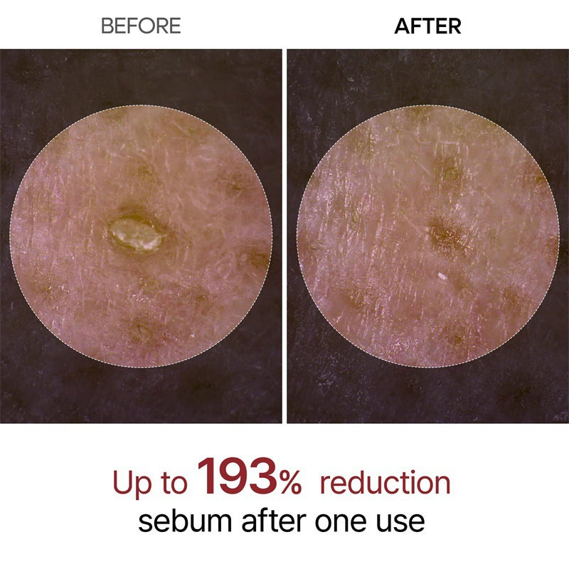 Dr. Melaxin Peel Shot Glow White and Black Rice Peeling Ampoule  (Choose 1 OR GET THE B/W SET FOR 35.99)